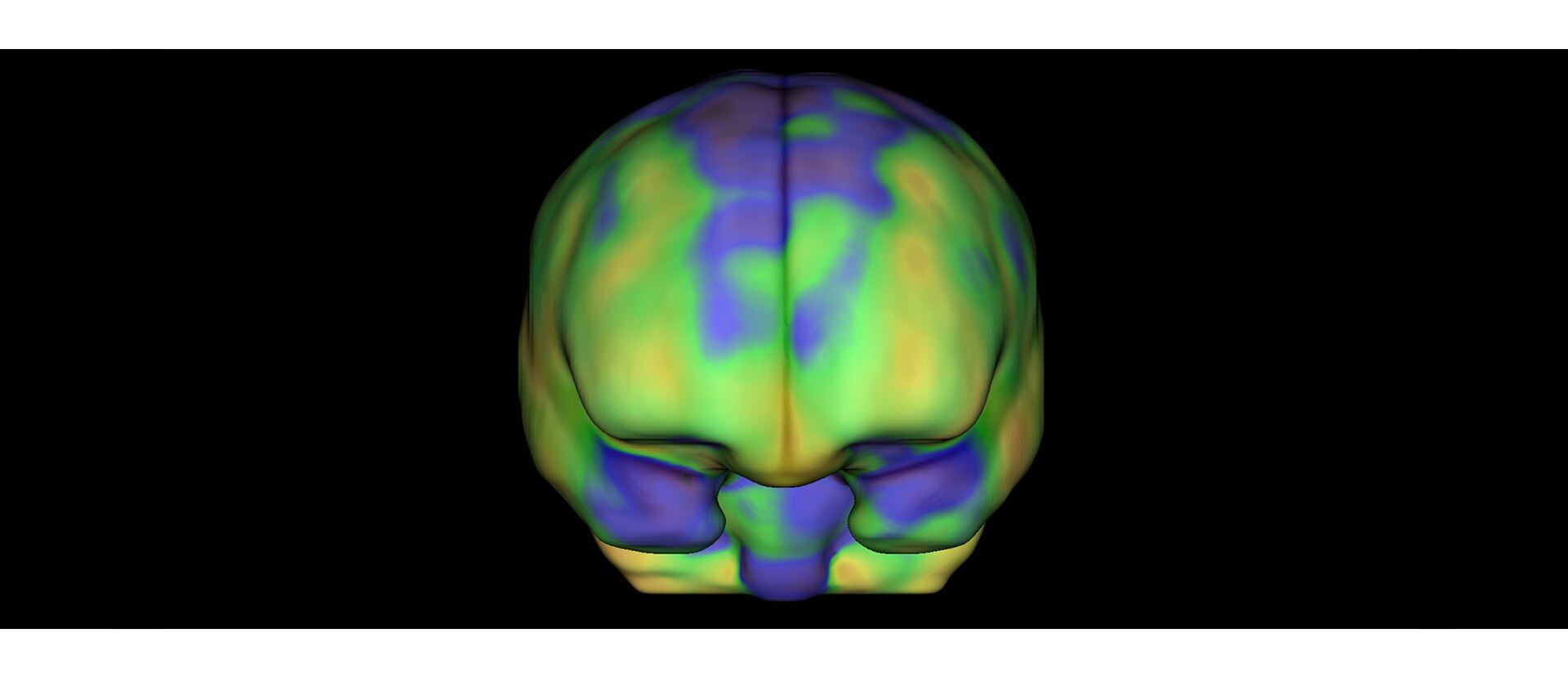 GEHC Xeleris 4 DR Q Brain Image 1 v1