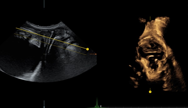 Pelvic Floor1