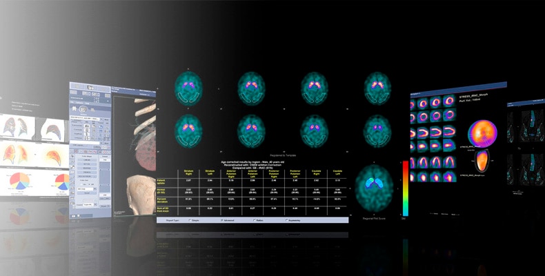 44562-education-course-SPECT-CT1