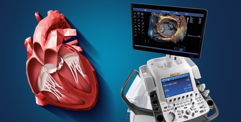 US01EKO-Vivid-E95-3D-4D-Advanced